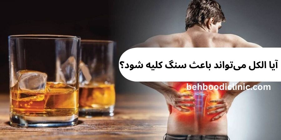  آیا الکل می‌تواند باعث سنگ کلیه شود؟